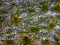 Облепиха под микроскопом <br />Sea Buckthorn Under a Microscope